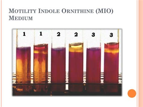 motility indole ornithine test.